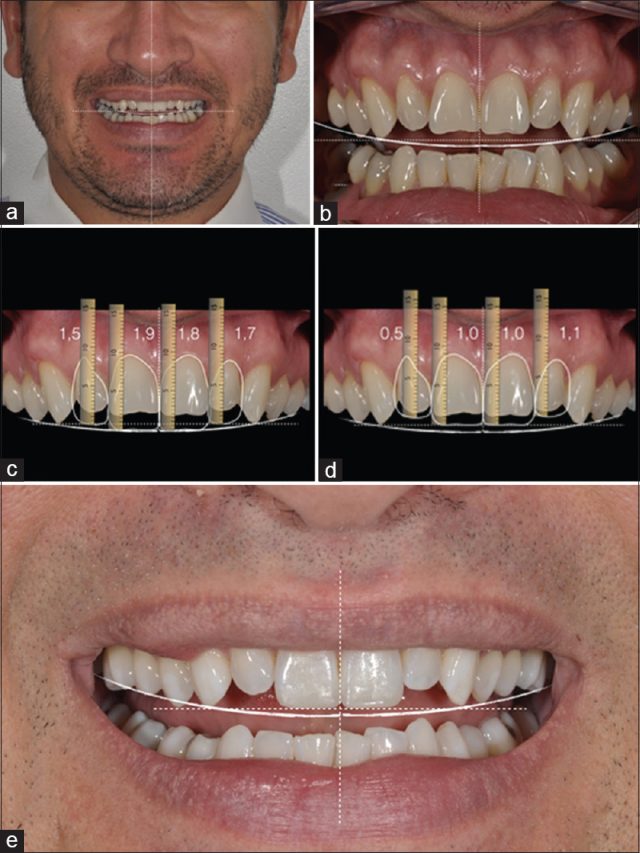 https://dentaltrip.co.uk/wp-content/uploads/2023/03/sm2-640x853.jpg